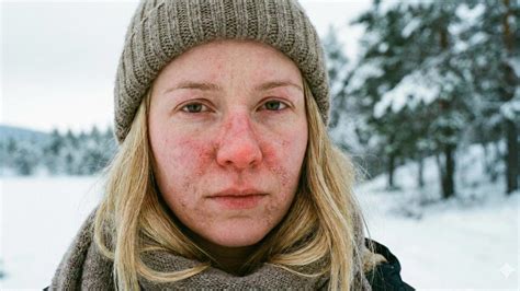 Kedy sa objaví hCG a ako ho správne interpretovať?